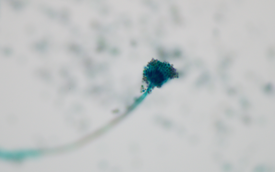 アスペルギルスの分生子柄（分生子頭）の細胞像