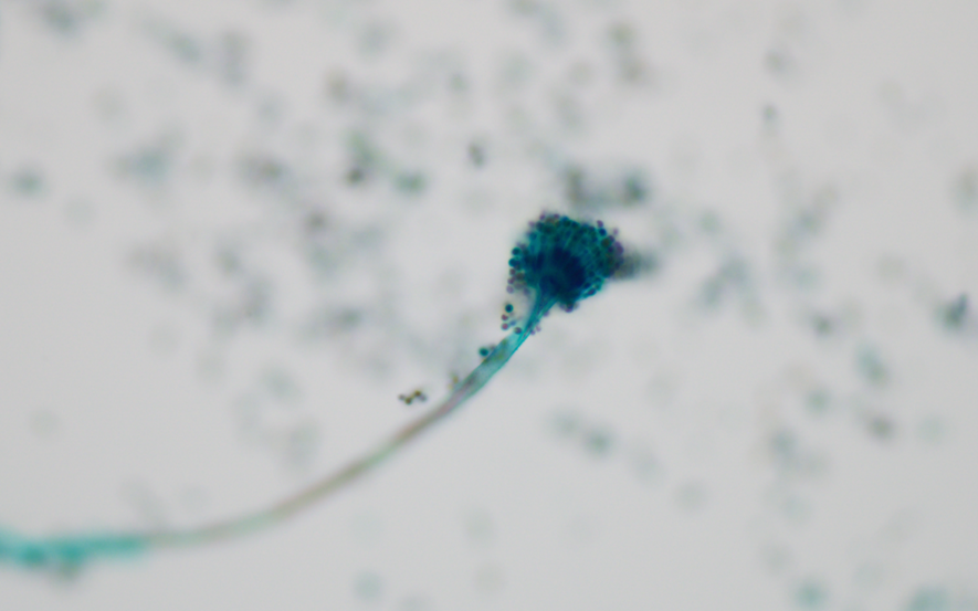 アスペルギルスの分生子柄（分生子頭）の細胞像