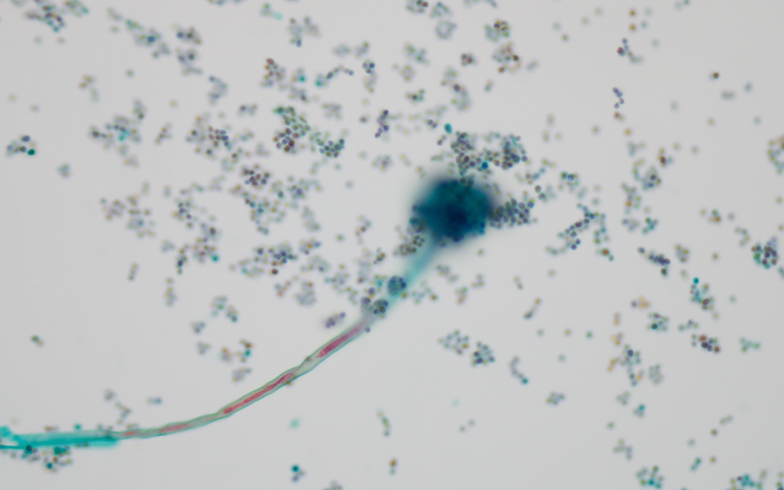 アスペルギルスの分生子柄（分生子頭）の細胞像