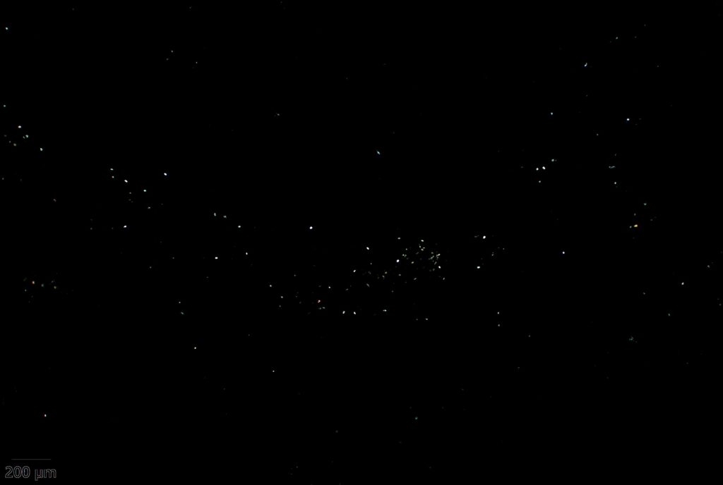 アスペルギルスが産生したシュウ酸カルシウム結晶(CaOX; calcium oxalate)