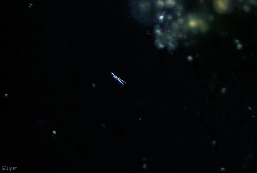 アスペルギルスが産生したシュウ酸カルシウム結晶(CaOX; calcium oxalate)針状の結晶が偏光顕微鏡で確認できる